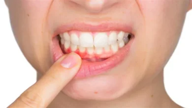 صورة لا تتجاهل نزيف اللثة.. قد يكون مؤشر لأمراض خطيرة