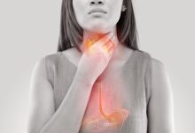 صورة 5 أسباب شائعة وراء حموضة المعدة.. لا تتجاهل السبب رقم 3