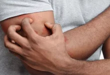 صورة احذر.. الحكة بعد الاستحمام قد تشير إلى أمراض خطيرة