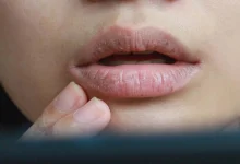 صورة 5 أسباب وراء وجود مرارة داخل الفم؟