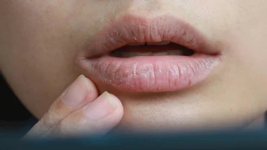 صورة 5 أسباب وراء وجود مرارة داخل الفم؟