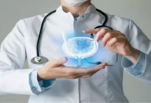 صورة يتجاهلها كثيرون.. 5 أعراض مبكرة لـ سرطان المثانة