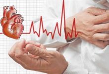 صورة طعام شهير يسبب جلطات القلب والدماغ.. احذر تناوله