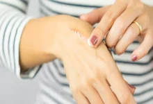 صورة لماذا نشعر بالألم حتى بعد زوال سببه؟