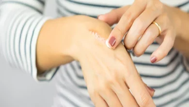 صورة لماذا نشعر بالألم حتى بعد زوال سببه؟