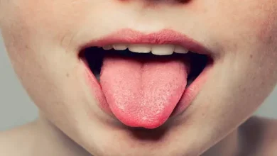 صورة احذر.. 5 عوامل تسبب سرطان اللسان