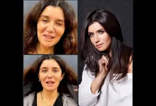 صورة بالفيديو والصور.. غادة عادل قبل وبعد عملية تجميل “شد الوجه”