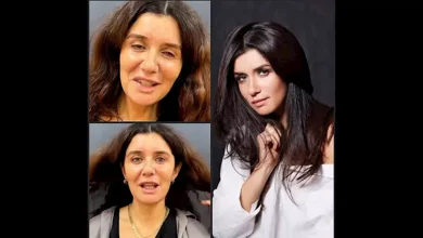 صورة بالفيديو والصور.. غادة عادل قبل وبعد عملية تجميل “شد الوجه”