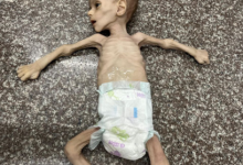 صورة الصحة العالمية: قطاع غزة يشهد حاليا أسوأ سيناريو للمجاعة