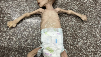 صورة الصحة العالمية: قطاع غزة يشهد حاليا أسوأ سيناريو للمجاعة