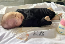 صورة 18 وفاة خلال 24 ساعة بسبب الجوع في غزة