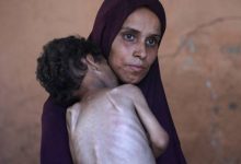 صورة | برنامج الأغذية العالمي:90 ألف امرأة وطفل في غزة بحاجة لعلاج فوري من سوء التغذية