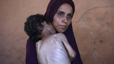 صورة | برنامج الأغذية العالمي:90 ألف امرأة وطفل في غزة بحاجة لعلاج فوري من سوء التغذية