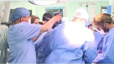 صورة الربيعة يعلن فصل التوأم السيامي السوري «سيلين وإيلين»