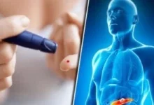 صورة علامات تحذيرية عاجلة تكشف عن إصابتك بمرض السكر