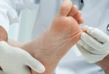 صورة أسباب التنميل في القدمين ومتى يشكل علامة خطر