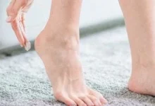 صورة أمراض تؤدي إلى تشقق الكعبين.. طرق الوقاية والعناية الفعالة