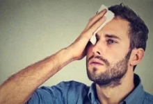 صورة تعرف على أسباب التعرق المفرط في الوجه والرأس
