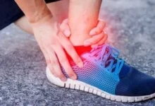 صورة أعراض ارتفاع الكوليسترول قد تظهر أولاً في كاحلك
