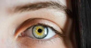 صورة طرق علاج التهاب ملتحمة العين في المنزل بسهولة وفعالية