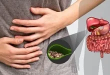 صورة أطعمة صديقة للمرارة وما ينبغي تناوله بعد استئصالها