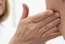 صورة أعراض تشبه الأنفلونزا قد تشير إلى نوع نادر من السرطان