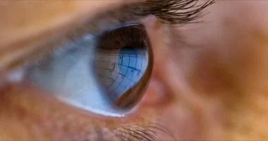 صورة علامات النوبة القلبية تظهر على العين.. لا تهملها