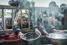 صورة سوء التغذية في غزة .. 5 حالات وفاة خلال 24 ساعة