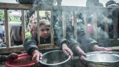 صورة سوء التغذية في غزة .. 5 حالات وفاة خلال 24 ساعة