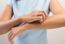 صورة ما يخبرك به الجلد عن صحتك.. علامات انتبه إليها