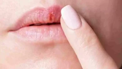 صورة الشفاه مرآة صحتك.. علامات لا تتجاهلها