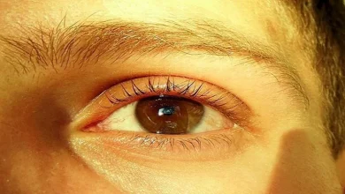 صورة احذر.. اصفرار الجلد علامة على الإصابة بهذه المشكلات الصحية