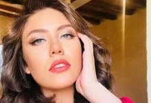 صورة بعد إصابة رحمة حسن به.. أسباب غير متوقعة تؤدي إلى الصلع