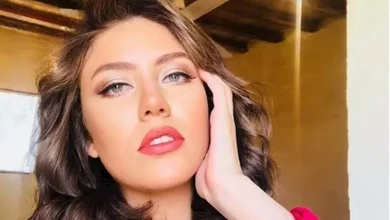صورة بعد إصابة رحمة حسن به.. أسباب غير متوقعة تؤدي إلى الصلع