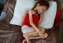 صورة طبيب بريطاني: غزة تواجه همجية من العصور الوسطى