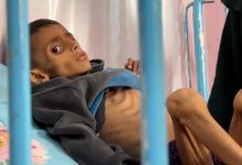 صورة وزارة الصحة: 5 شهداء جدد نتيجة سوء التغذية بغزة