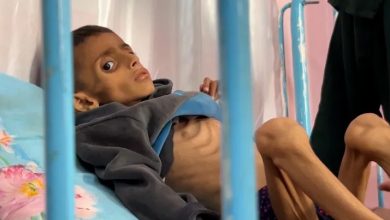 صورة وزارة الصحة: 5 شهداء جدد نتيجة سوء التغذية بغزة