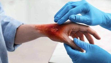 صورة «جلد في حقنة».. تقنية جديدة لعلاج الحروق والجروح الخطيرة  أخبار السعودية