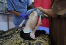 صورة غزة: ارتفاع وفيات التجويع الإسرائيلي إلى 162 فلسطينيا بينهم 92 طفلا