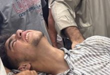 صورة | إصابة الناشط الفلسطيني عبود بطاح برصاص الاحتلال أثناء تغطيته معاناة منتظري المساعدات في غزة
