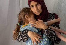 صورة وفاة طفلة في مدينة غزة نتيجة المجاعة