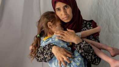 صورة وفاة طفلة في مدينة غزة نتيجة المجاعة