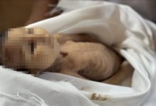 صورة الرضيعة “غدير بريكة” ضحية جديدة لسياسة التجويع الإسرائيلي في غزة..