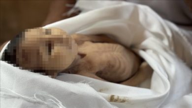 صورة الرضيعة “غدير بريكة” ضحية جديدة لسياسة التجويع الإسرائيلي في غزة..