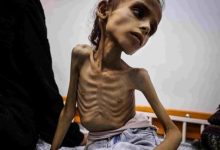 صورة صحة غزة: ارتفاع شهداء التجويع الإسرائيلي إلى 193 بينهم 96 طفلا