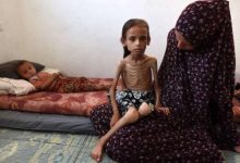 صورة سوء التغذية ينهش أطفال غزة.. مريم تفقد أكثر من نصف وزنها وحياتها في خطر (صور وفيديو)