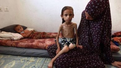صورة سوء التغذية ينهش أطفال غزة.. مريم تفقد أكثر من نصف وزنها وحياتها في خطر (صور وفيديو)