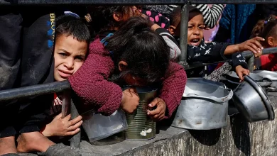 صورة انتشار سوء التغذية فى غزة وارتفاع الوفيات المرتبطة بالجوع