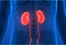 صورة العوامل النفسية تلعب دوراً محورياً في الوقاية من أمراض الكلى