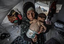 صورة طفلة بوزن 4 كيلوغرامات… جسد صغير يتآكل بصمت في غزة المجوّعة